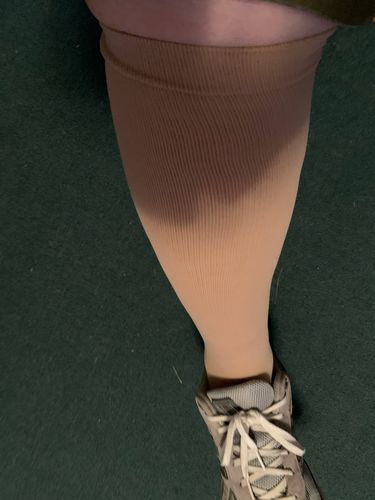 Customer photo review of Open Toe: 20-30 mmHg - Nude