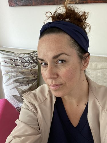 Customer photo review of Le Pigmentum - Hyperpigmentation Treatment