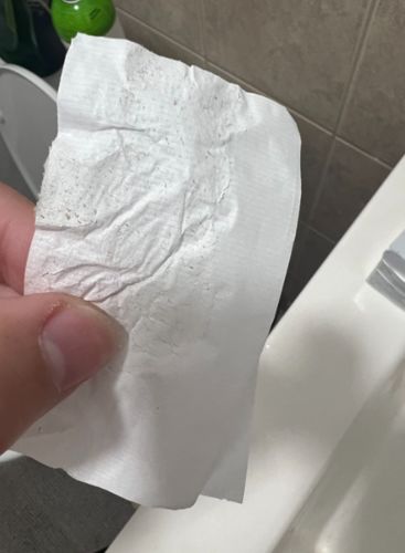 Customer photo review of Lanbena™ - Nose Plants Pore Strips