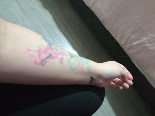 Customer photo review of Depilador Nuva Skin®