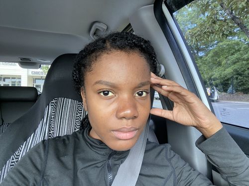 Customer photo review of Rice Oil Scalp Boost