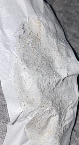 Customer photo review of Lanbena™ - Nose Plants Pore Strips