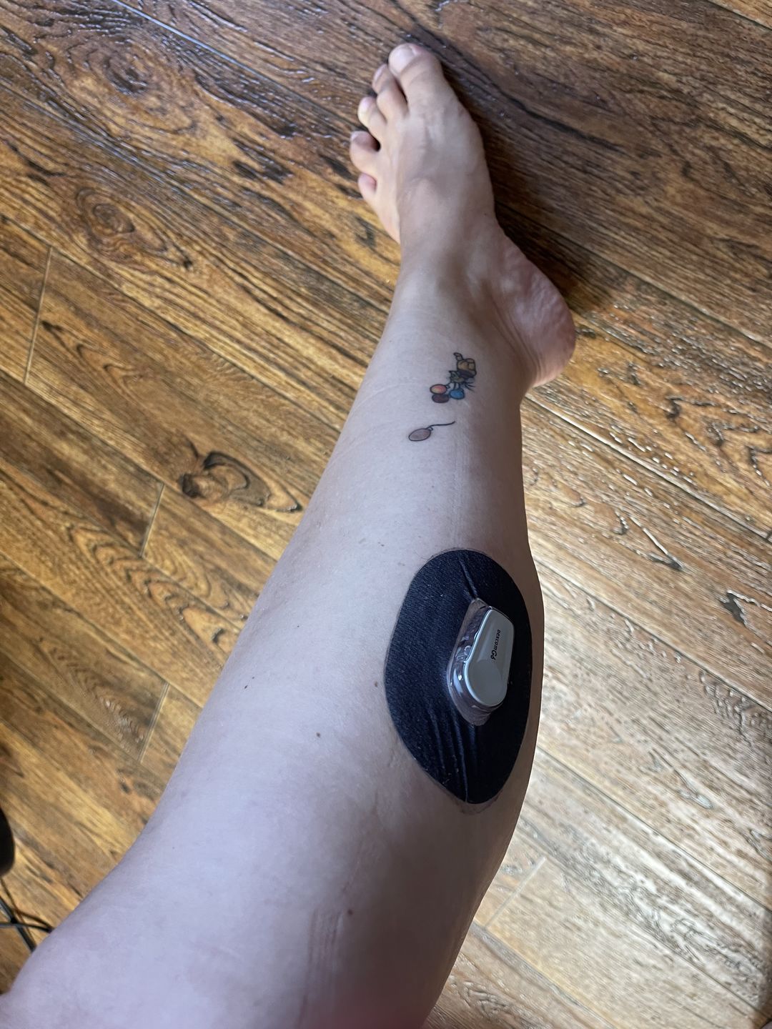 Customer photo review of Skin Grip MAX Dexcom G6 Patches