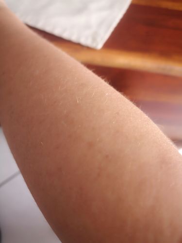 Customer photo review of Good Sun Vitamins Auto-bronzant - 1 mois