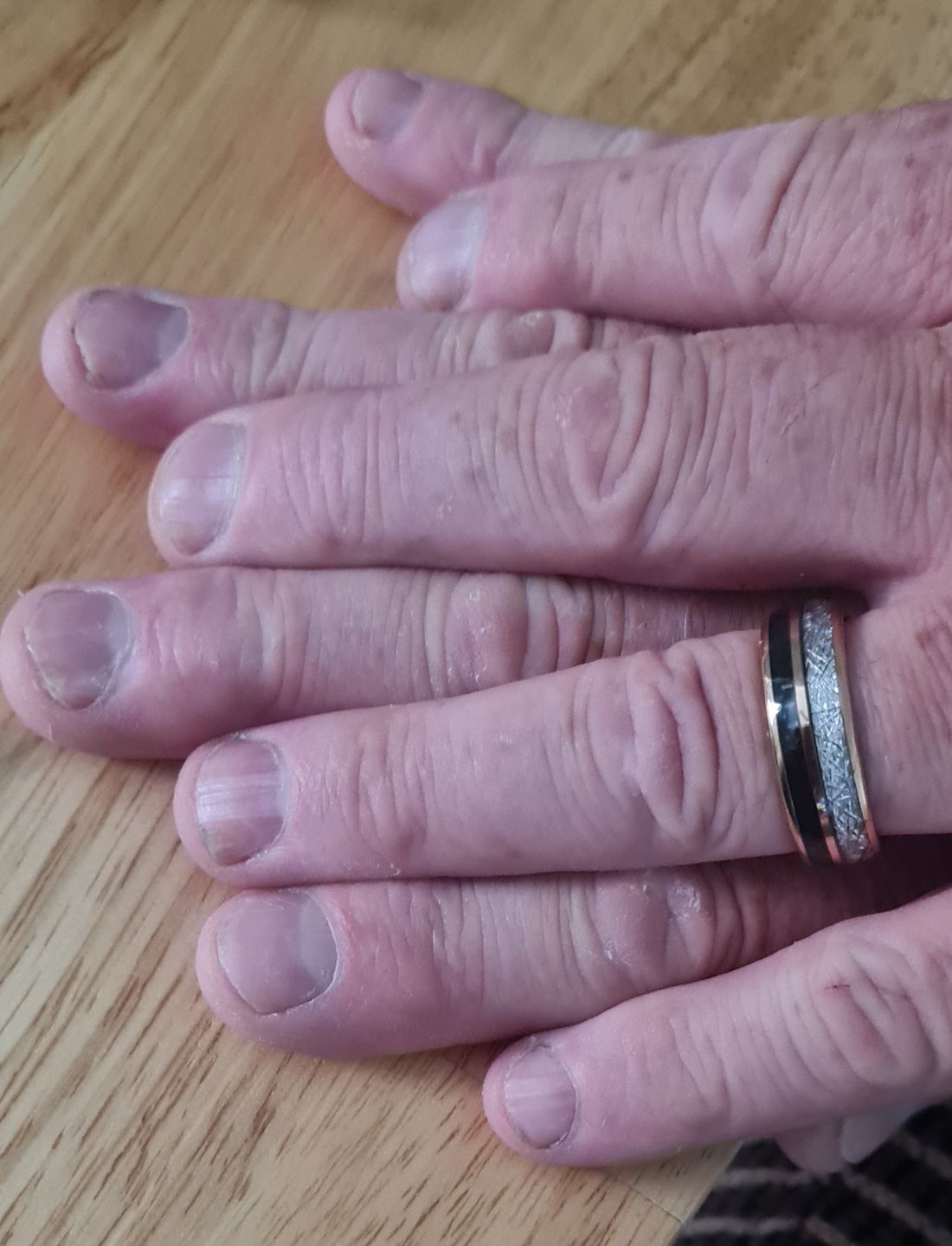 Customer photo review of The Rosie Black 8mm Wonder Ring