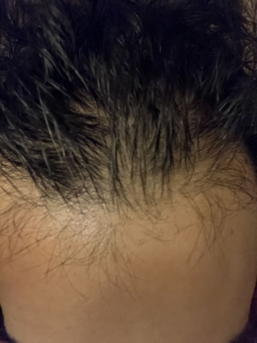 Customer photo review of Tónico Anticaída