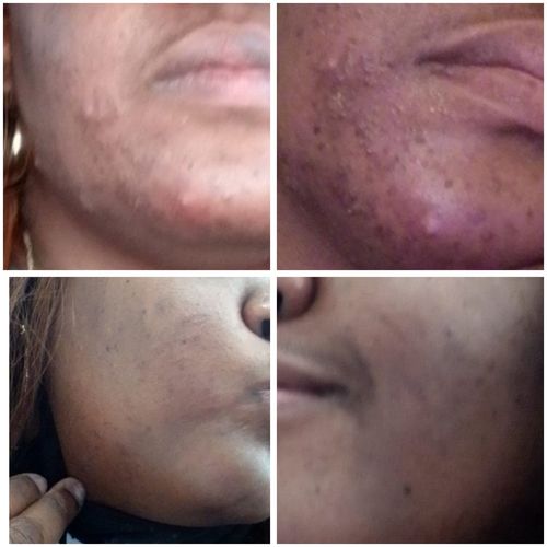 Customer photo review of Chlorophyll - Spearmint Flavour