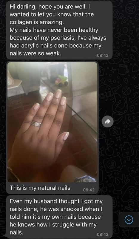 Customer photo review of Beauty: Bovine Collagen, Hyaluronic Acid, Vitamin C & Biotin (250g)