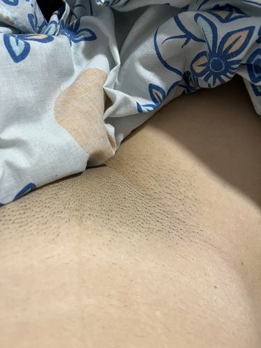 Customer photo review of Rasuradora MyHUEVOS® 3.0 PRO