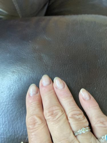 Customer photo review of Route Package Protection