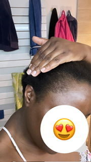 Customer photo review of SOIN ACTIVATEUR DE POUSSE
