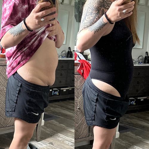 Customer photo review of ContourFlex Sculpting Bodysuit