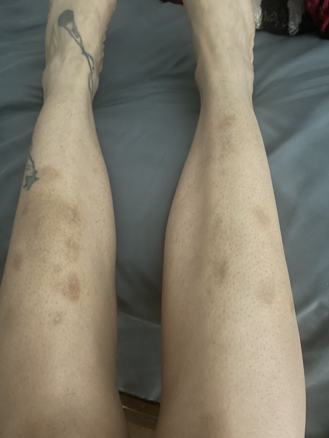 Customer photo review of Body Restore Combo