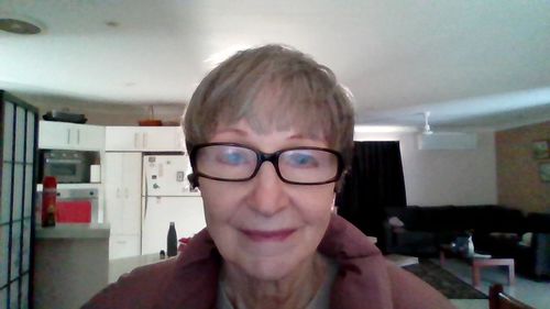 Customer photo review of EvenSkyn® Lumo: Premium Anti-Aging & Skin Tightening Handset