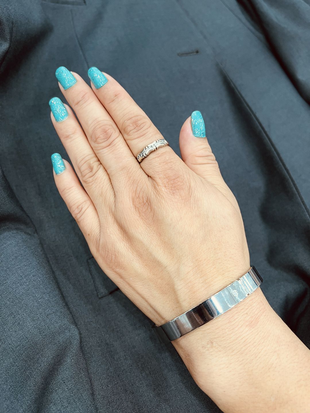 Customer photo review of Spark Bracelet