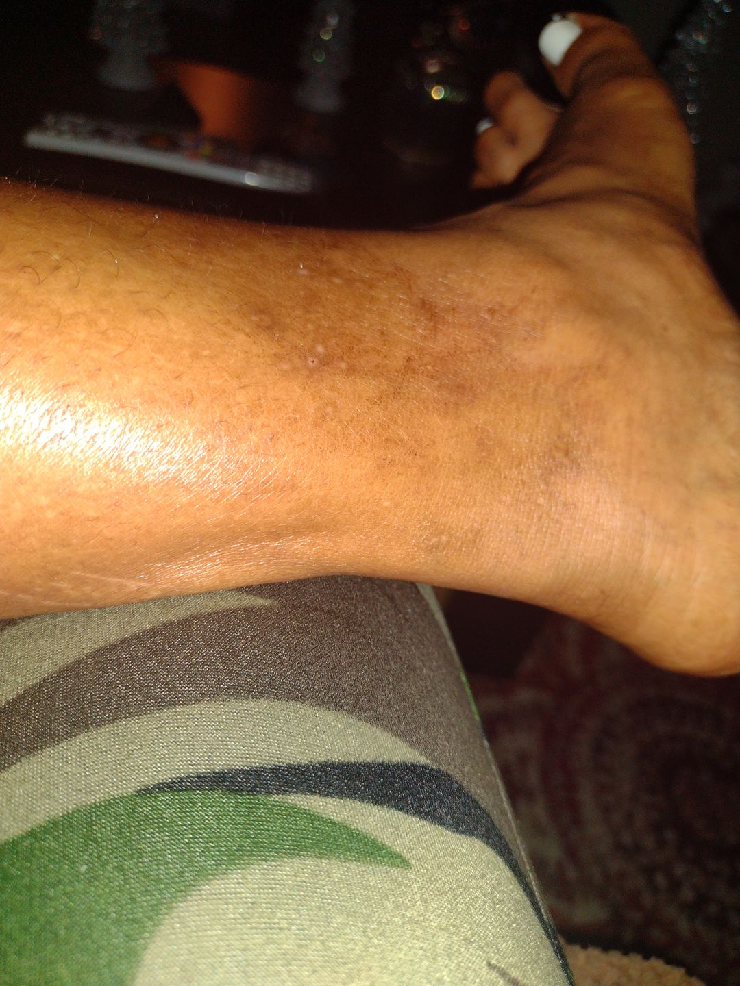 Customer photo review of Magix Cream