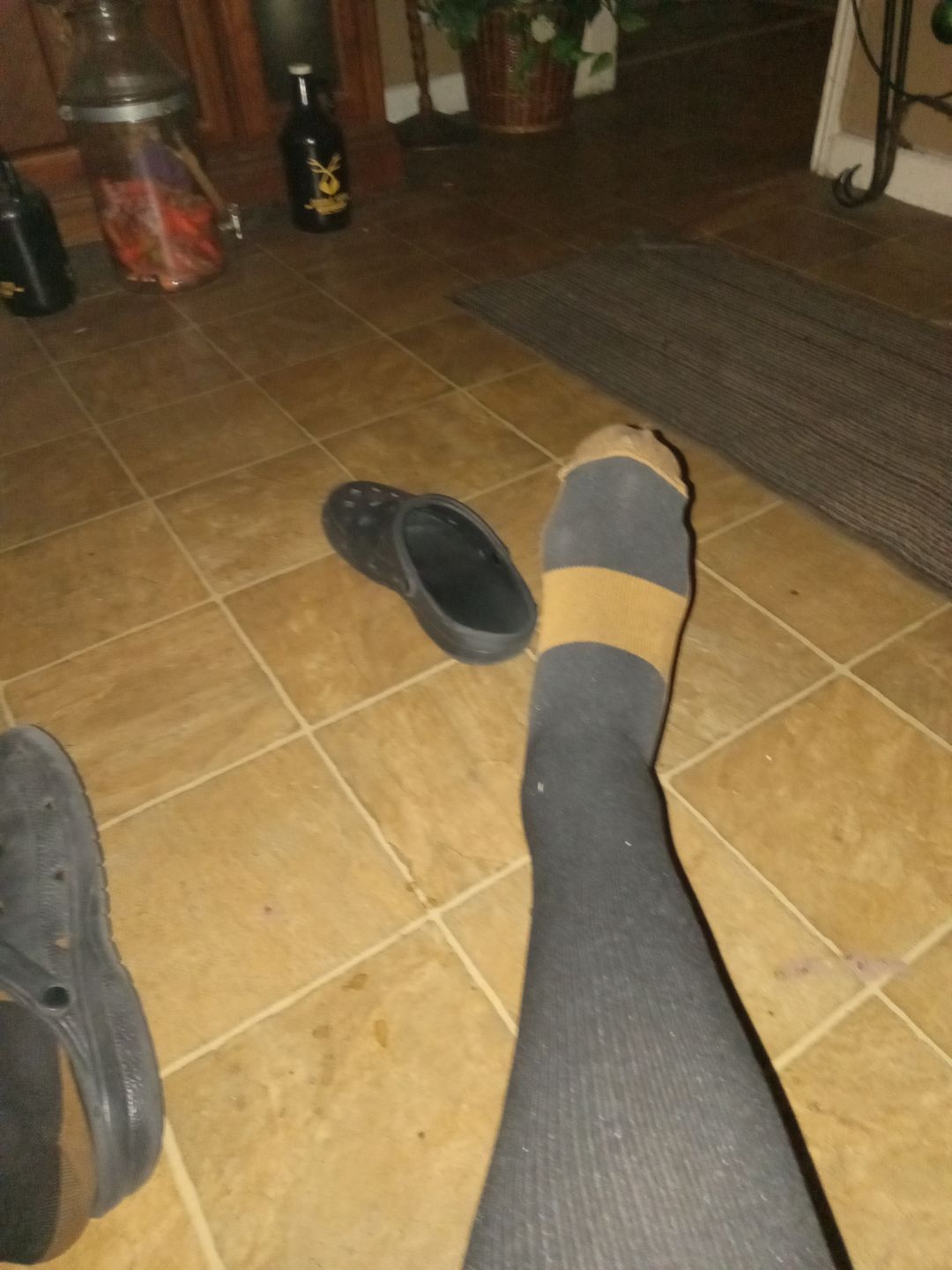 Customer photo review of Copper Compression Socks (3-Pack)