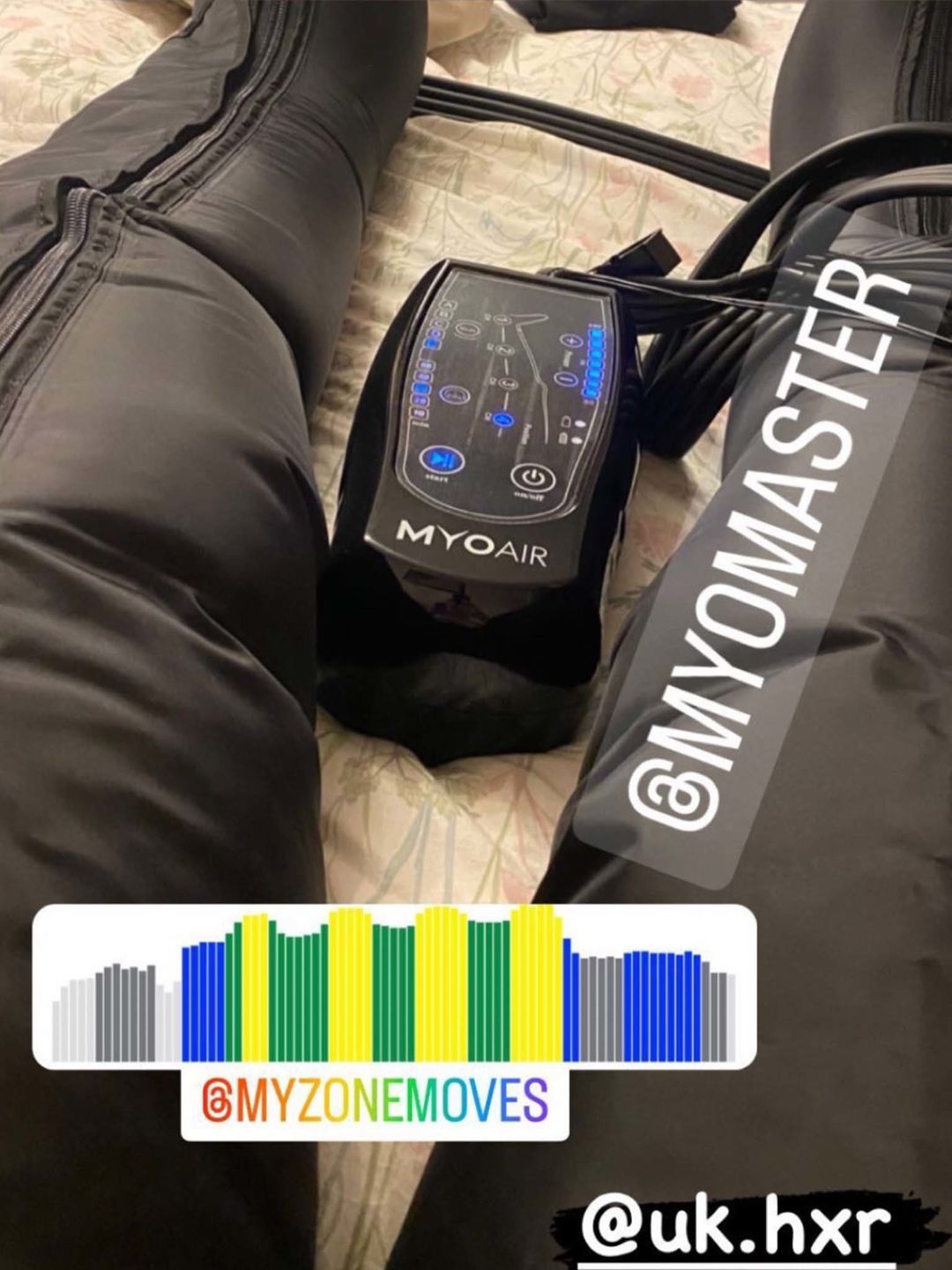 Customer photo review of MyoAir