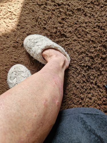 Customer photo review of Multi Strain Biotic