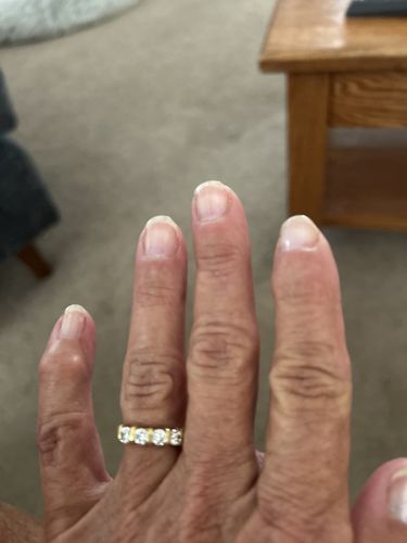 Customer photo review of Rocket Nail Fuel Duo