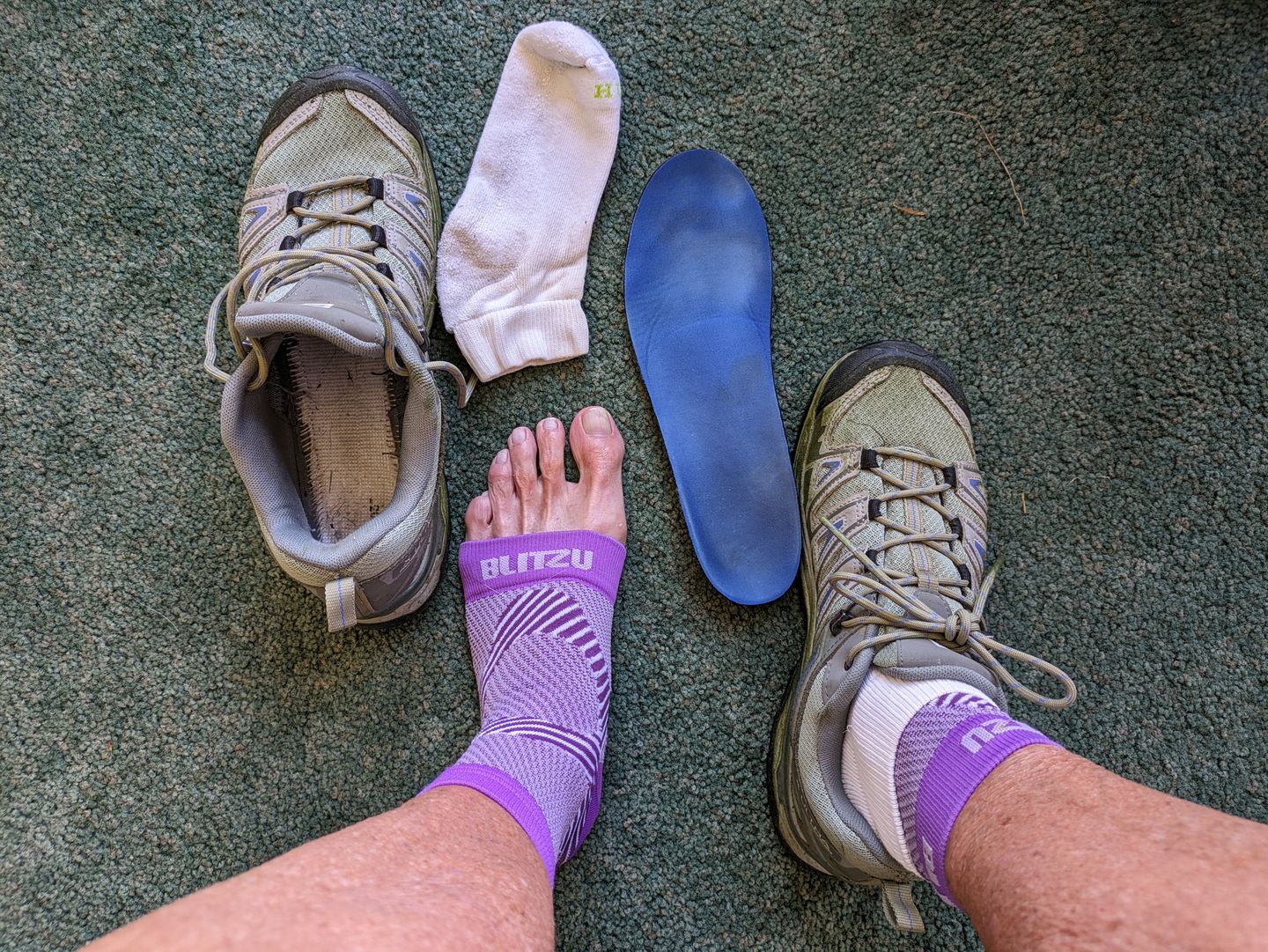 Customer photo review of Ankle Sleeves | Neuropathy Compression Socks | Plantar Fasciitis Socks