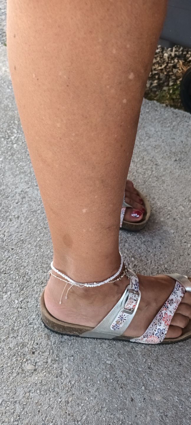 Customer photo review of Gomme Dépilatoire Gomépil™