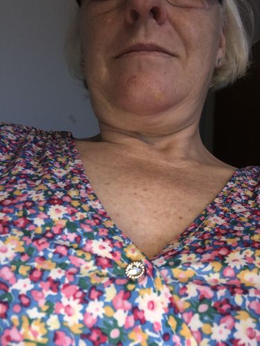 Customer photo review of Anti-eksponering faste brocher (10 stk. pr. sæt)