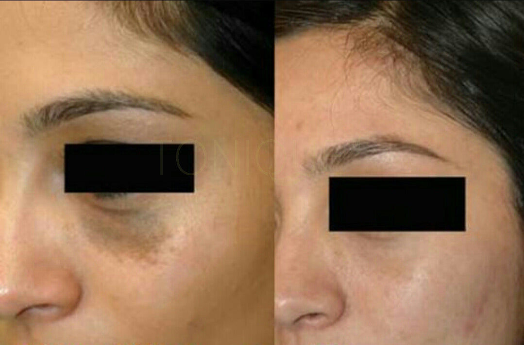 Customer photo review of 10X Cream - Facial Skin Whitening Cream - Tonique