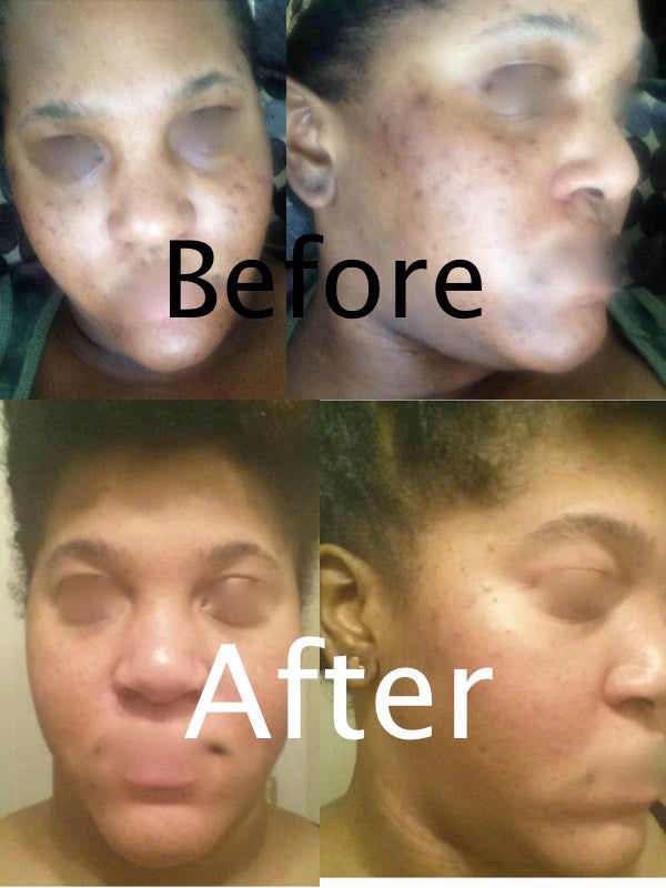 Customer photo review of 10X Cream - Facial Skin Whitening Cream - Tonique