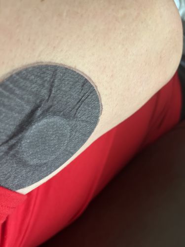 Customer photo review of Skin Grip MAX Freestyle Libre Patches
