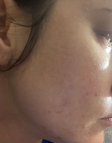 Customer photo review of 40-Day Inside & Out™ Gut Program