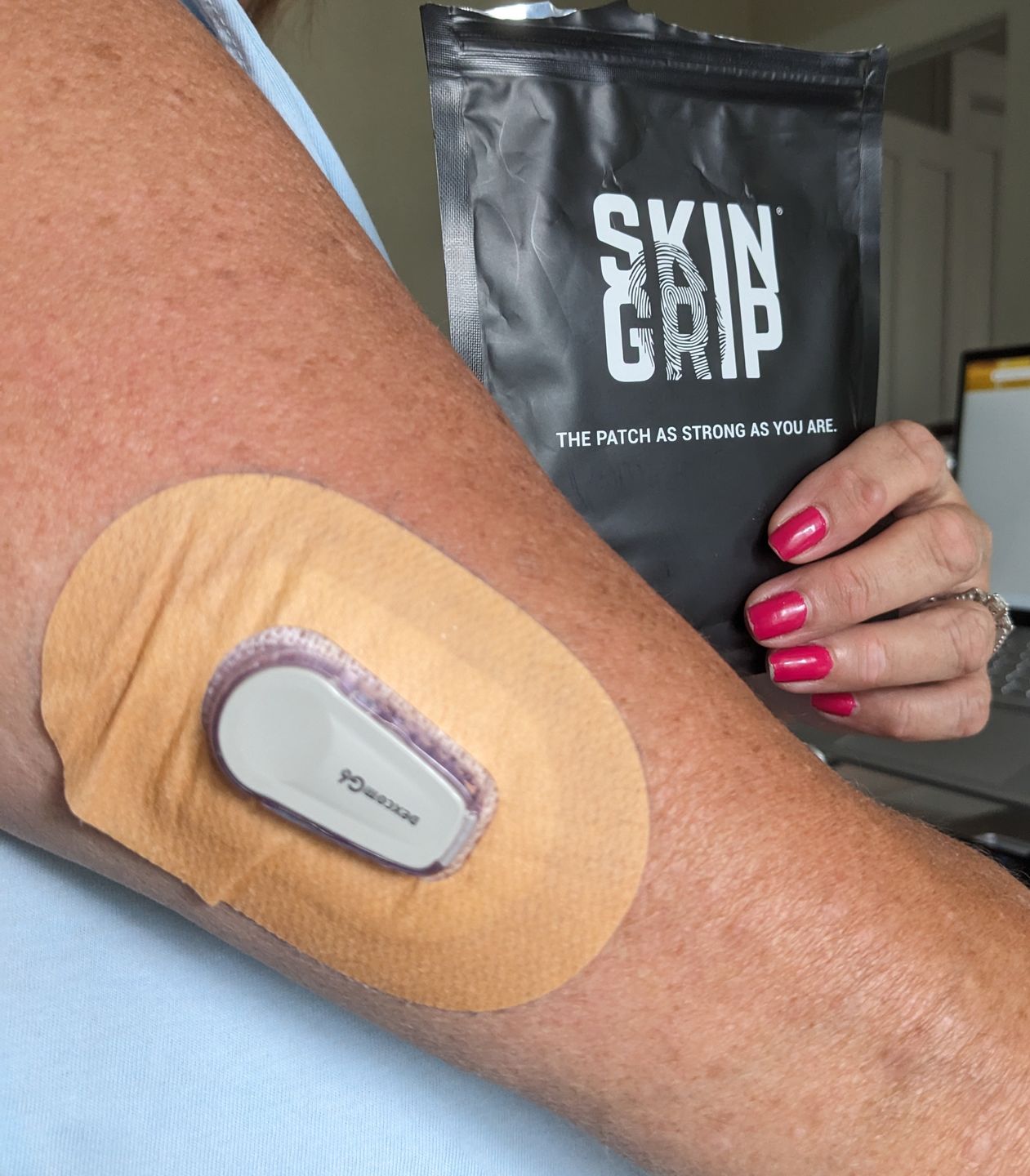 Customer photo review of Skin Grip MAX Dexcom G6 Patches