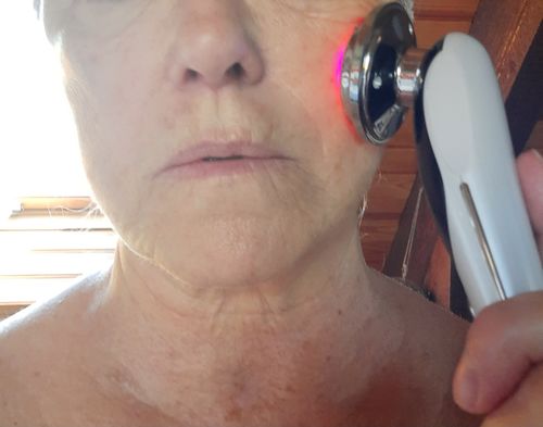 Customer photo review of LightPro 7en1 Fontanay™ Lifting Luminothérapie