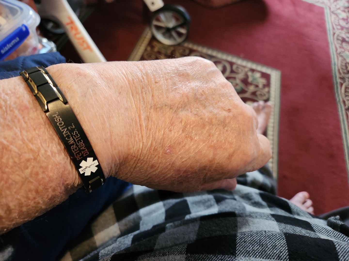 Customer photo review of Black Medical Alert Bracelet