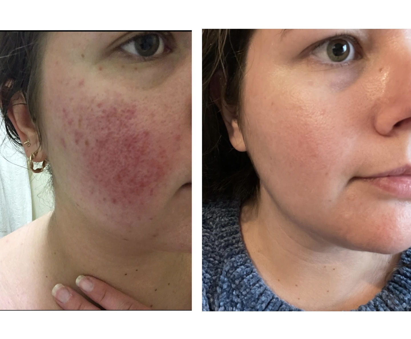 Customer photo review of The Flower Face Cream