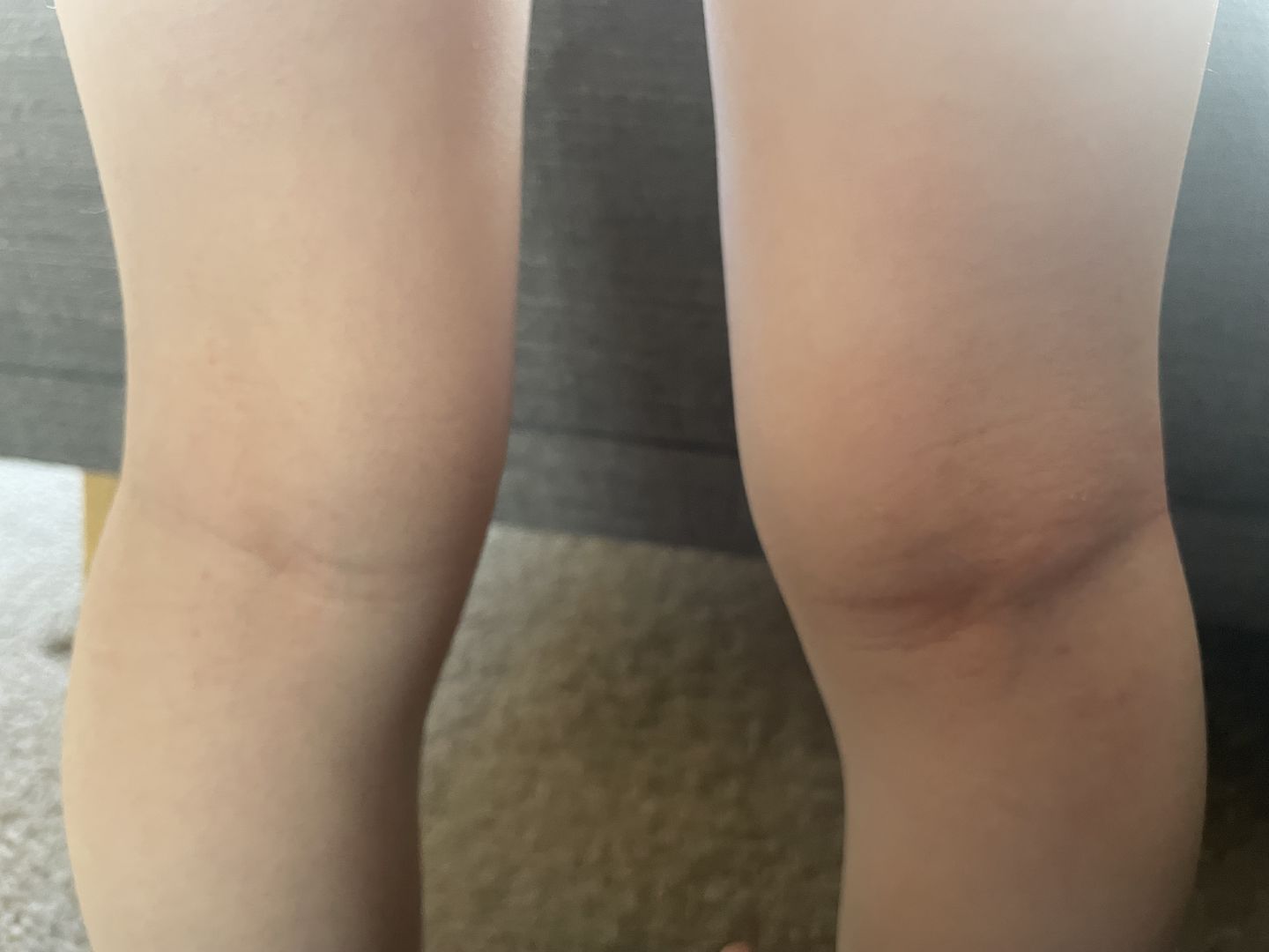 Customer photo review of Organic Barrier Balm