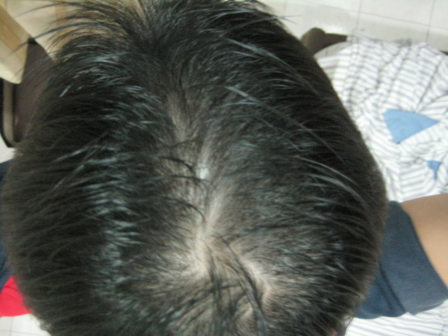 Customer photo review of [ SMIB ] - Hair Growth & Repair Kit Set - 1st Order Promotion Malaysia
