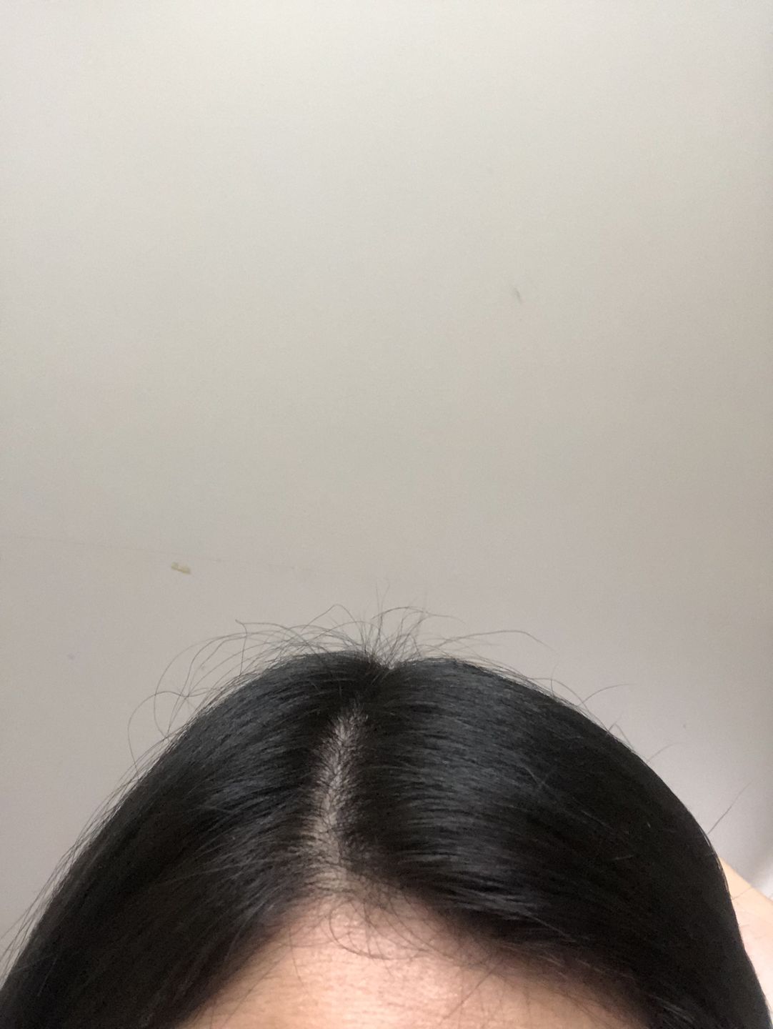 Customer photo review of Tónico Anticaída