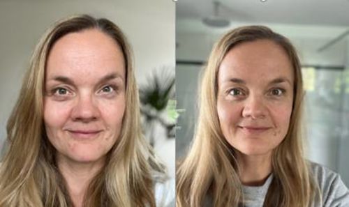 Customer photo review of Hochwirksame Pflegeroutine gegen Alterung