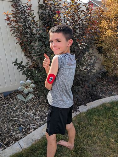 Customer photo review of Skin Grip Original - Kids Dexcom G6 Patches