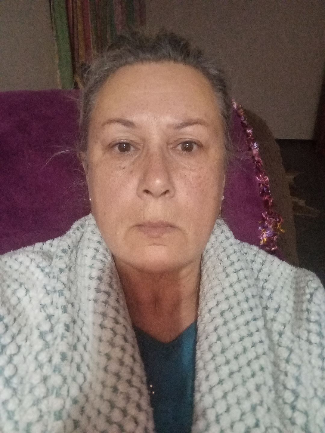 Customer photo review of Noche Y Dia Vitamin C Serum (30ml)