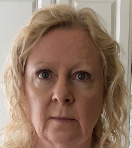 Customer photo review of Rosalique 3 in 1 Anti-Redness Miracle Formula SPF50