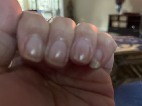 Customer photo review of Rocket Nail Fuel Nail Repair - Clear