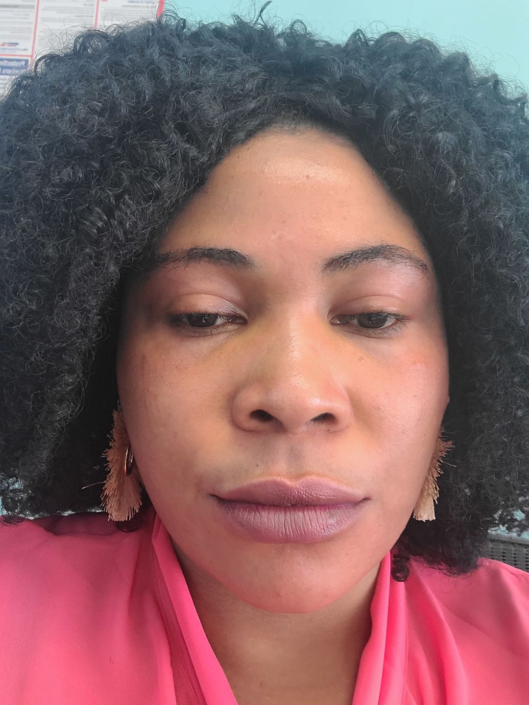 Customer photo review of Clarifying Milk Soap with Shea Butter and SPF 50