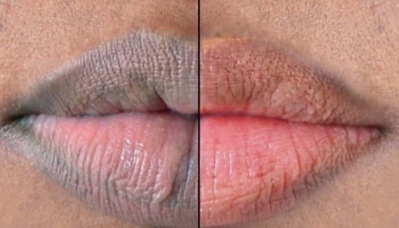 Customer photo review of Pink Lip Kit