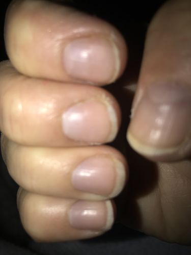 Customer photo review of Rocket Nail Fuel Nail Repair - Clear