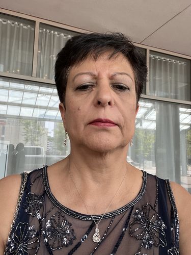 Customer photo review of EvenSkyn® Lumo: Premium Anti-Aging & Skin Tightening Handset