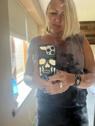 Customer photo review of Just Love Skulls Hollow Phone Case