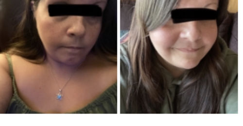 Customer photo review of Semaglutide Weight Loss Program