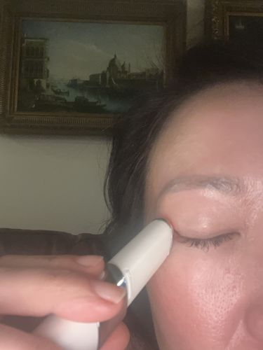 Customer photo review of EvenSkyn® Lumo: Premium Anti-Aging & Skin Tightening Handset